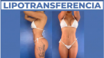 Foto de Lipotransferencia en Medellín