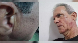Represión intelectual en Cuba: Militar da golpiza al escritor Jorge Fernández Era