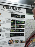 Decálogo para la prevención de la celulitis
