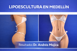Excelencia en Cirugía Estética: Lipoescultura y Rinoplastia en Medellín con el Dr. Andrés Mojica