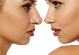 Naturalidad en cirugía plástica facial de los Doctores Valencia  