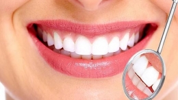 ¿DÓNDE PONERSE CARILLAS DENTALES EN MADRID? 