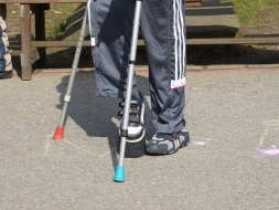 Hacia una sociedad accesible con sillas salvaescaleras