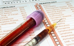 Il doping nel ciclismo