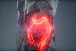 ¿Por qué los médicos no explican los remedios para el síndrome de colon irritable?