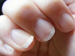 Apuesta por tu belleza con estos tips para fortalecer las uñas