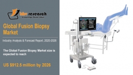 Fusion Biopsy Market Size Worth $912.5 Million By 2026 - KBV Research