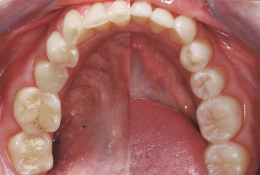 Sonrisas radiantes y salud bucal óptima: Descubre la Odontología Restauradora de Vanguardia en Rossell & Carol