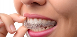 ¿Es la ortodoncia Invisalign adecuada para mí?