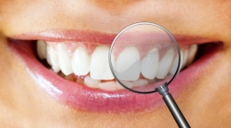 En Argentina, 9 de cada 10 adultos padecen algún tipo de patología gingival
