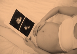 Sufrimiento fetal y encefalopatía hipóxico Isquémica