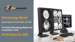 Teleradiology Market to reach a market size of $8 billion by 2025- KBV Research